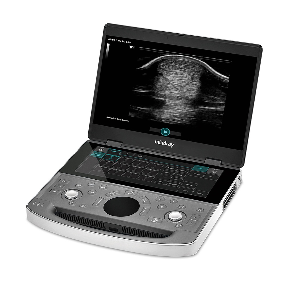 [A3045500202] Vetus EQ promotional package + 2 transducers of your choice, Linear Rectal (6LE5Vs - 304518), Linear T-shaped (L13-3Ns - 305092) or Abdominal Convex (C5-1s - 304551) + 12x ultrasound gel (Głowica liniowa w kształcie litery T, Liniowa głowica rektalna)