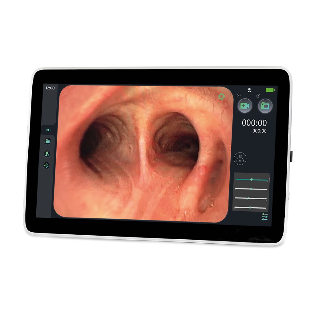 EickView SD endoskopimonitor, 15,6" touchskærm, til semi-disposable endoskoper