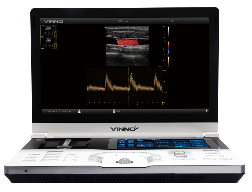 VINNO 5 VET ultralydsscanner