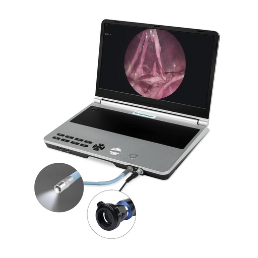 [306106] EickView 4-in-1 kompakt endoszkóp rendszer
